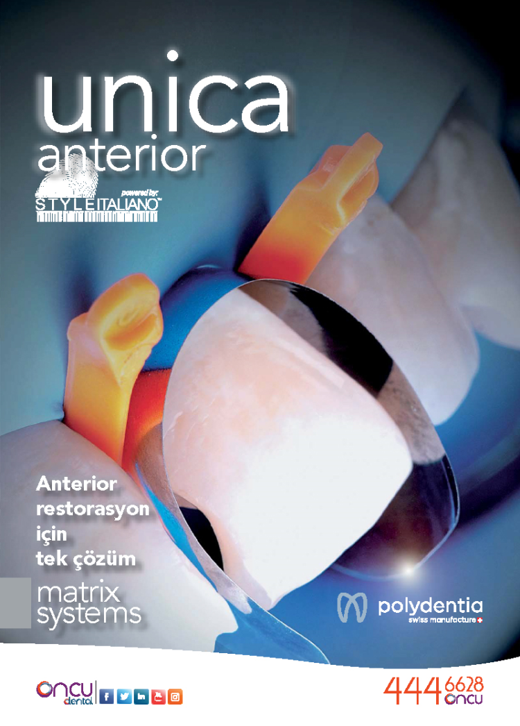 TDB 167 | Unica Anterior