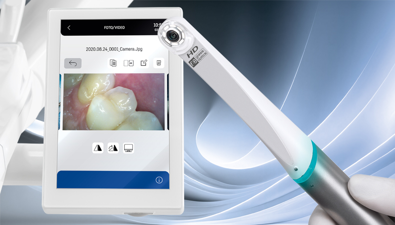 AREA intraoral kamera