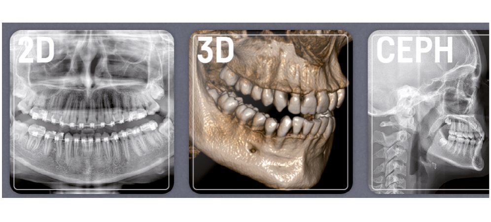 X-Radius Compact 2D, 3D ve CEPH görüntüleri