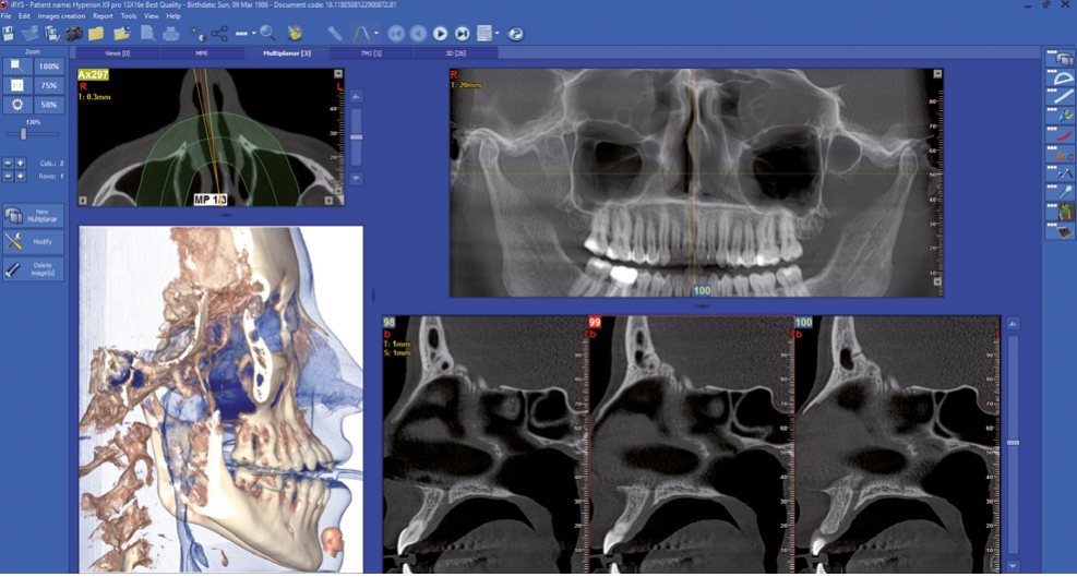 X-Radius Trio Plus 3D görüntüleme yazılımı