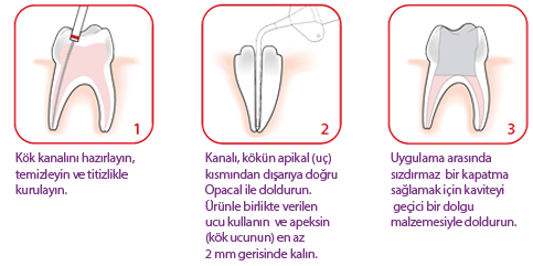 PD Opacal uygulama sistemi