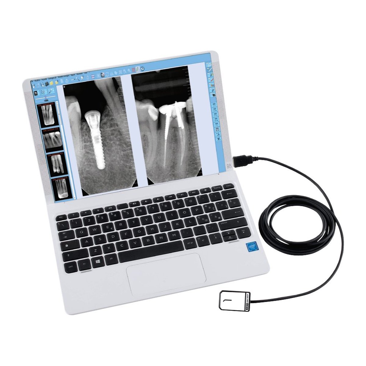 Castellini XVS HD Rvg 1 No Sensör
